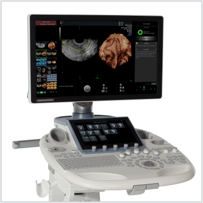 Voluson S8 – GE HealthCare